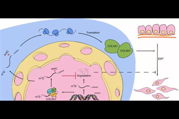 mRNA 乙酰化修饰解密胃癌转移新机制
